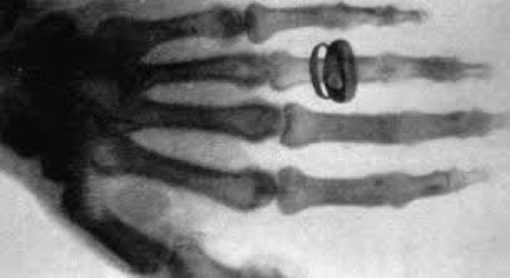 Wilhelm Roentgen fa la primera radiografia